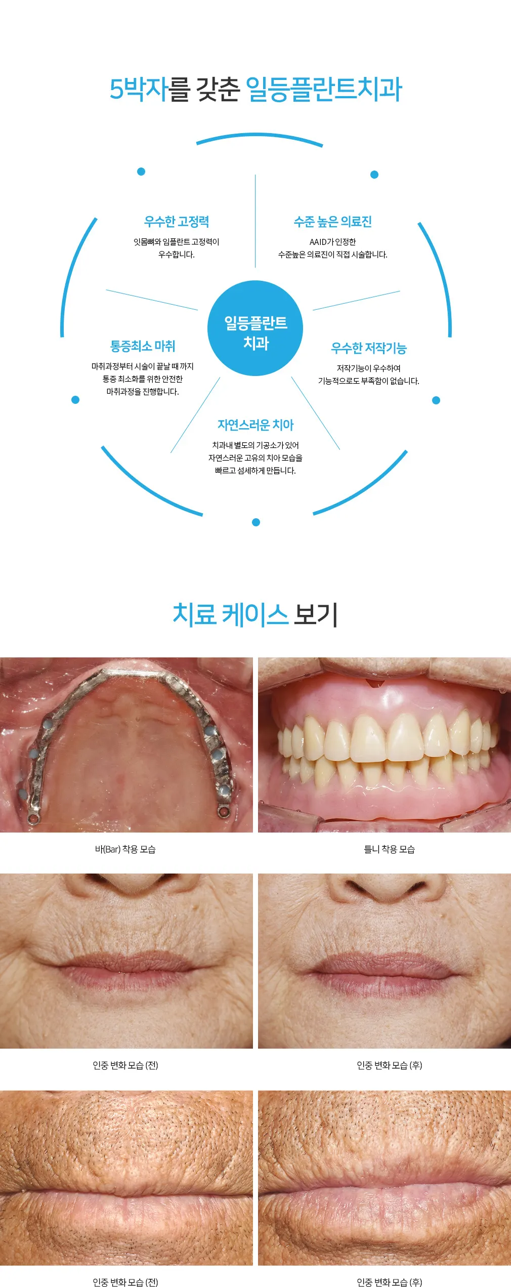 07 3 — 일등플란트치과의원